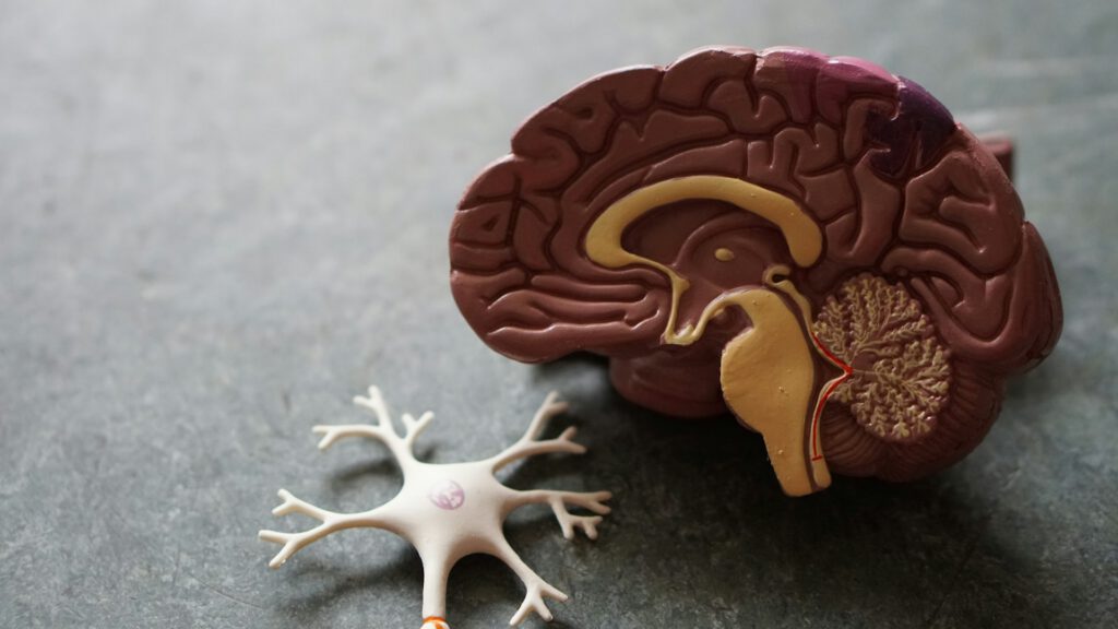 Cálculo renal: reconhecer sintomas, tratar com segurança e reduzir recorrência